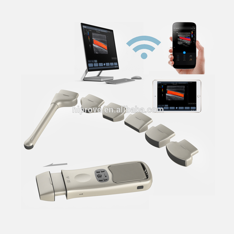 Wireless Handheld Pocked Color Doppler Ultrasound