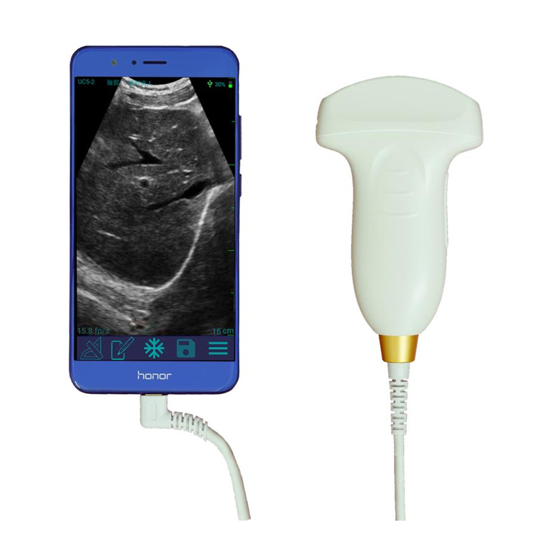 USB Convex Probe/ USB Ultrasound Scanner
